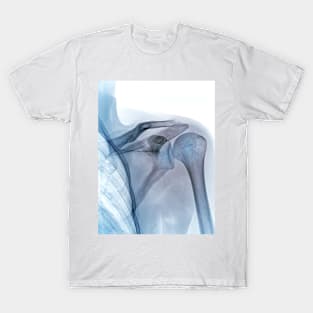 Shoulder joint, X-ray (C040/3239) T-Shirt